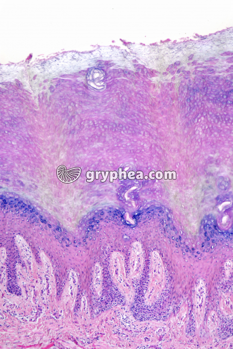 Peau plante du pied CT x25 - gryphea.org